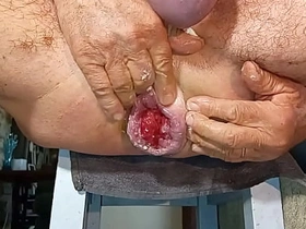 扩肛侠2025-14 chinese and white gay massage porn