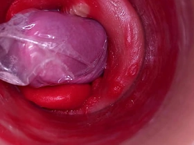 深入阴道的摄像头记录下带着套套的巨量射精 asian gay ai porn